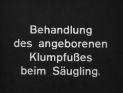 Behandlung des angeborenen Klumpfußes beim Säugling