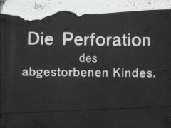 Die Perforation des abgestorbenen Kindes